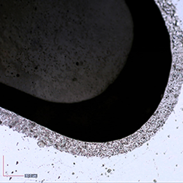 foerdertechnik_pumpen-anwendungsbereiche-anwendungsbeispiele_konturtreue-cct_plating
